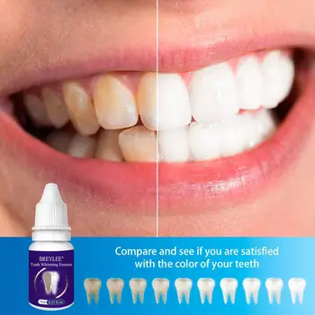 BREYLEE Bielenie Zubov Podstate zubná pasta Zubná Biele Zuby Čistenie Ústnej Hygieny Kefka Gél na Odstránenie Plaku Škvrny 10 ml