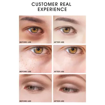 ARTISCARE Zlaté Repair Eye Cream Očný Tašky z Vrásky Krém na Oči Zdvíhacie Proti Starnutiu Tmavé Kruhy Zubov Hydratačné